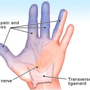 Book Now - Understanding & Treating the Limbs & Joints