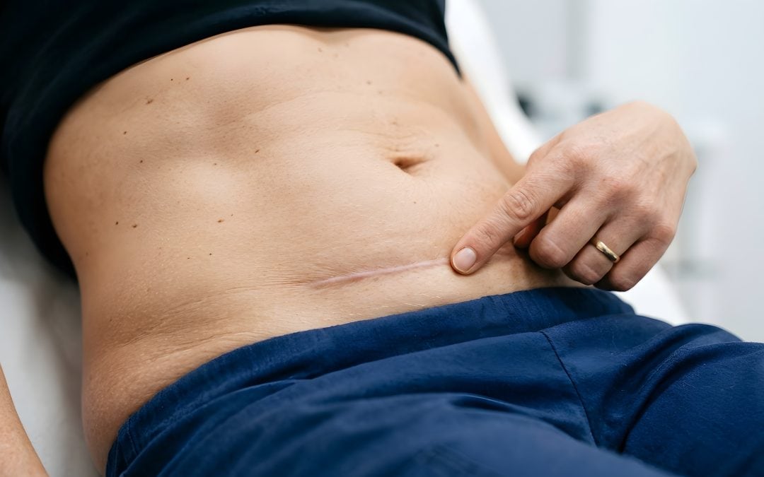 Scar Therapy Practitioner Diploma